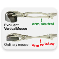 Evoluent VerticalMouse 4 Small - Vertikale Maus